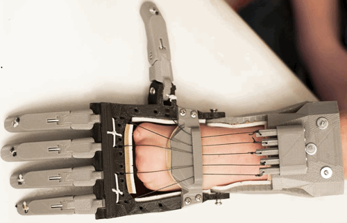 Prótesis de una mano hecha con impresora 3D - Iniciativa E-Nable